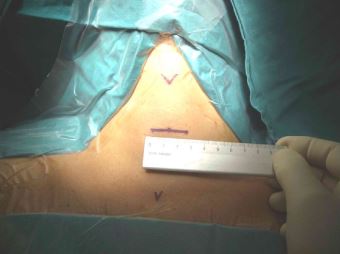 Tiroide normale - Cmed Roma