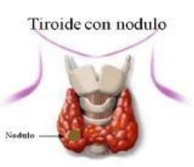 Tiroide anormale - Cmed Roma