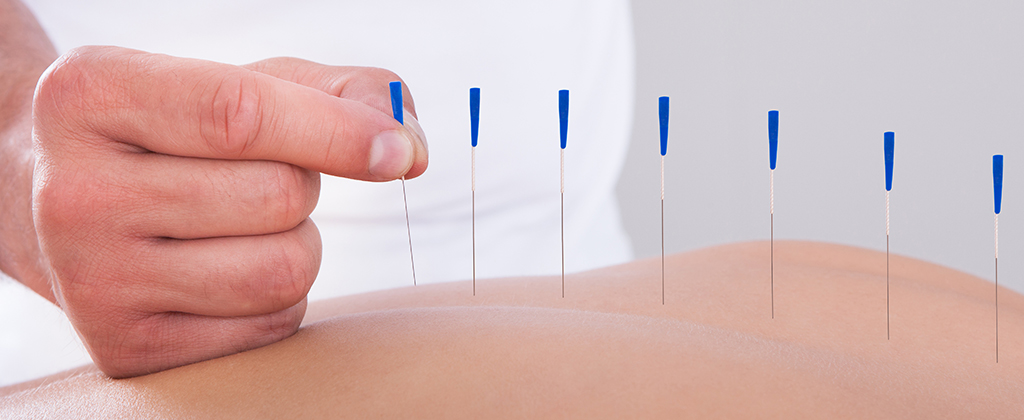 Agopuntura: benessere del corpo e della mente | Centro Medico CMed & Partners Roma