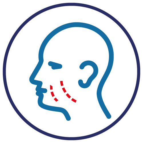 ico-maxillo-facciale