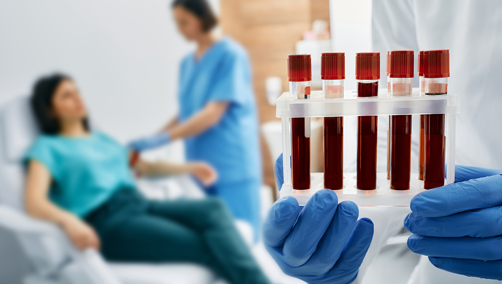 importanza-analisi-sangue-5